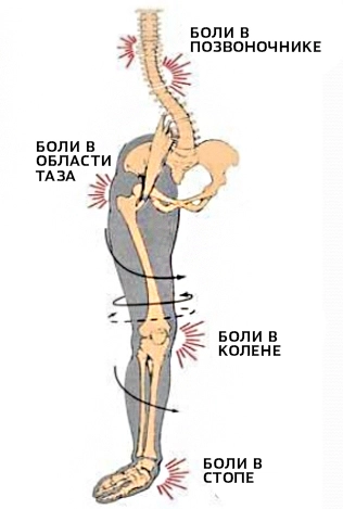 Боли в суставах