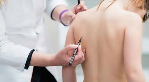 Искривление осанки у детей