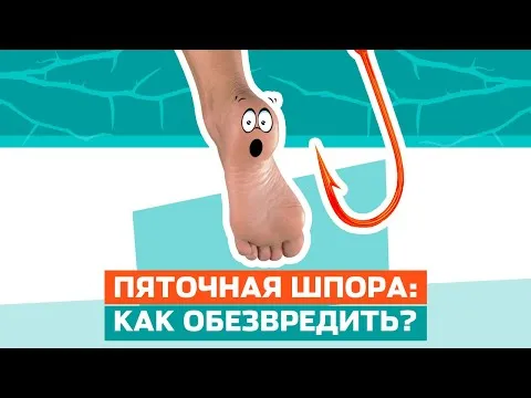 Средство от пяточной шпоры