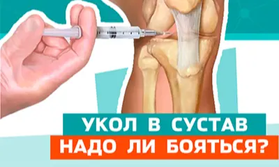 Укол в сустав. Какие ощущения?